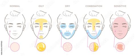 Skin Types 的图像结果