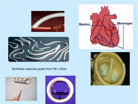 Image result for Design for Process Examples