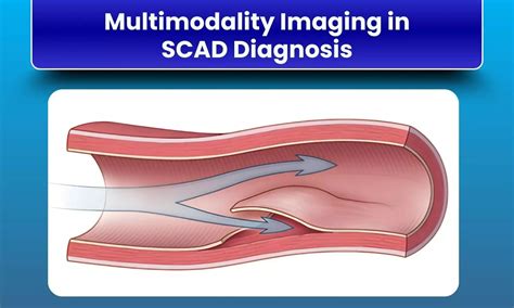 Systematic Review Highlights Multimodality Imaging Essential for ...
