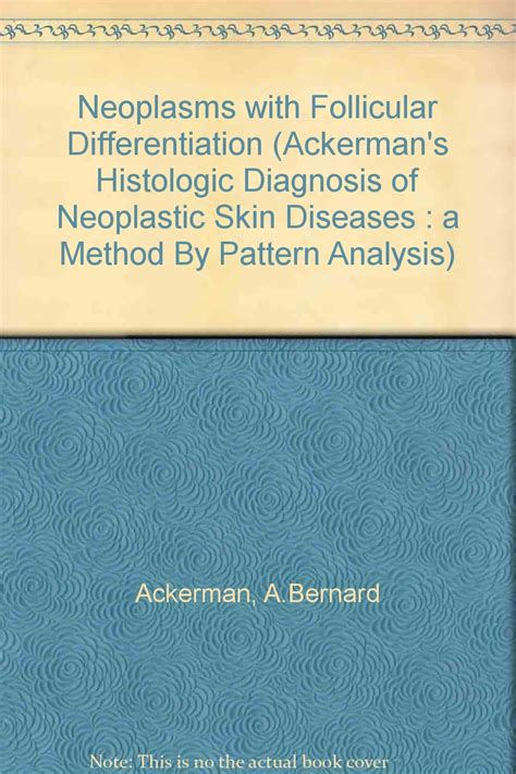 Buy Neoplasms with Follicular Differentiation (Ackerman's Histologic ...