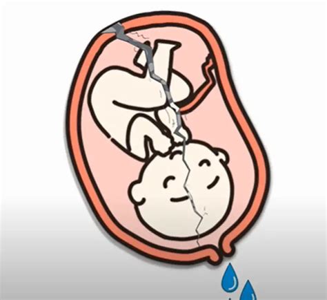 Can You Leak Amniotic Fluid if Your Cervix Is Closed? Solved