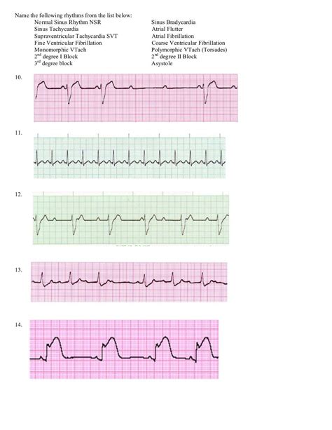 Pin by Liz Clavijo on Paramedic | Acls, Ekg interpretation, Basic life ...
