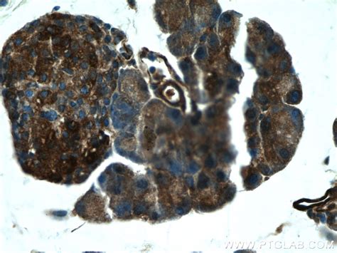 XYLT1 antibody (55061-1-AP) | Proteintech