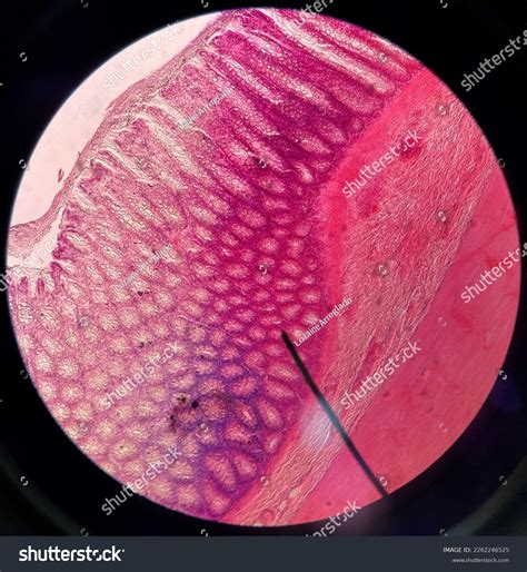 Function Of Simple Columnar Epithelium In Large Intestine at Jackson ...