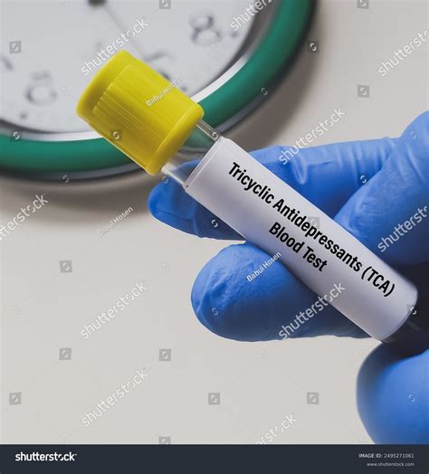 Blood Sample Tricyclic Antidepressant Tca Drug Stock Photo 2495271061 ...
