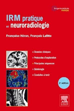 Buy Irm Pratique En Neuroradiologie Book Online at Low Prices in India ...