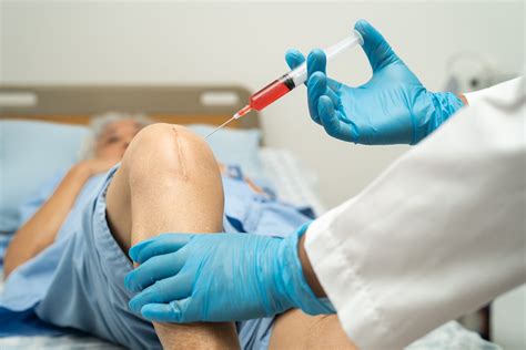 Platelet Rich Plasma (PRP) Injection for knee Osteoarthritis (OA) And Knee replacement Surgery