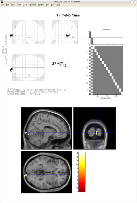 Image result for MATLAB SPM Model Analysis