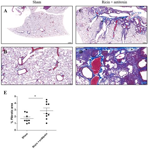 Long-Term Pulmonary Damage in Surviving Antitoxin-Treated Mice ...