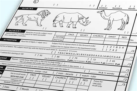 Moca Test Explained 的图像结果