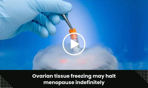 Ovarian tissue freezing may halt menopause indefinitely