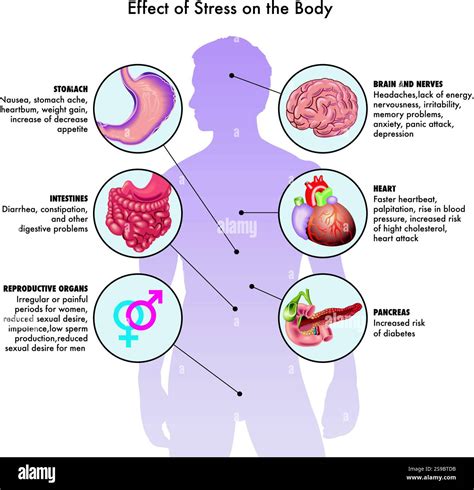Medical illustration of effect of stress on the body, with annotations Stock Vector Image & Art ...