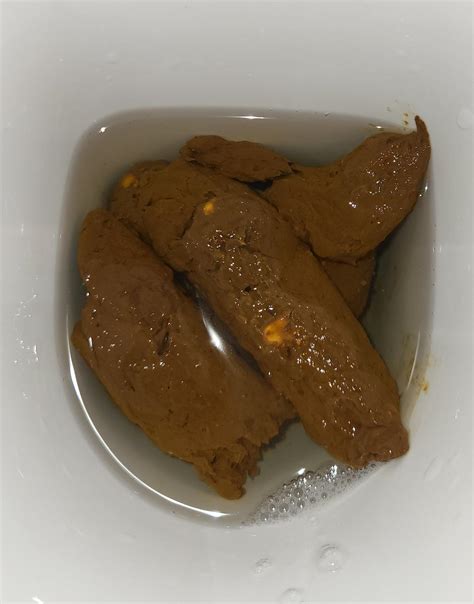 Bright red blood in stool- hemorrhoids or something else? : r/poop