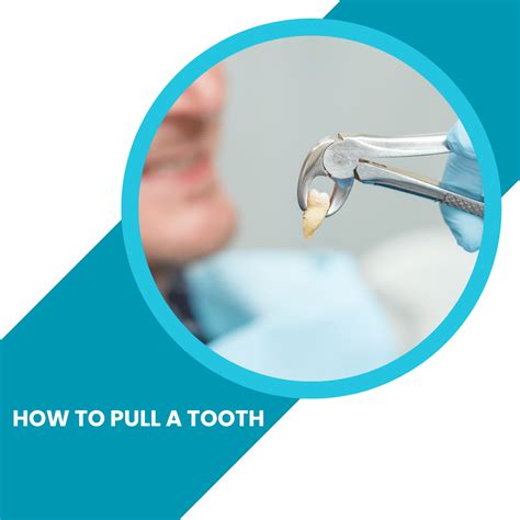 Image result for Pulled Tooth