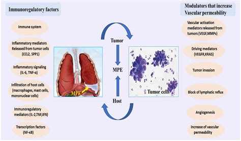 Malignant pleural effusion diagnosis and therapy