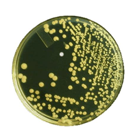Tryptic Soy Agar (TSA) Composition, Principle, Preparation,, 49% OFF