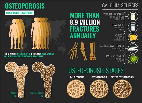 What Causes Osteoporosis In Men Understanding Osteoporosis In Men