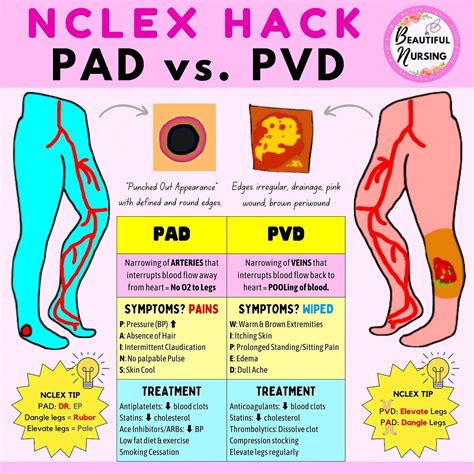 Peripheral artery disease – Artofit