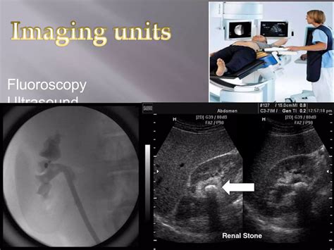 Extracorporeal shock wave lithotripsy (eswl) | PPTX
