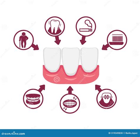 Recession Teeth 的图像结果