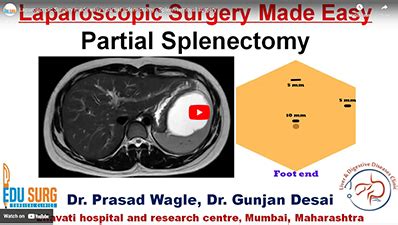 Videos - Step By Step Surgery | EduSurg