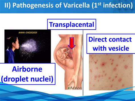 Lecture 5 Varciella-Zoster virus.pptx