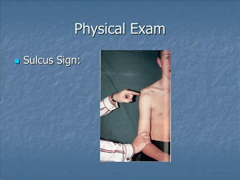 Image result for Sulcus Sign Shoulder Dislocation