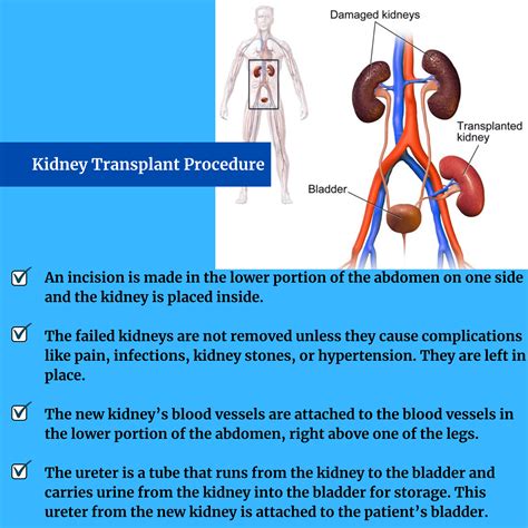 Kidney Transplant Surgeon in India - Best Nephrologist in India - Online Nephrologist Consultation