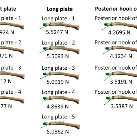 Image result for Acromion Function