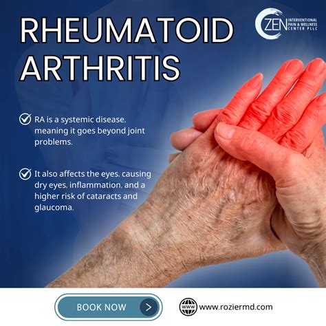 Rheumatoid Arthritis Mansfield: 7 Symptoms You Shouldn't Ignore!