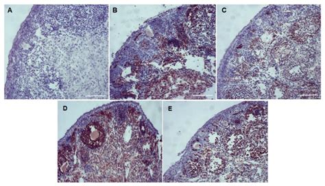 Protective Effect of Cimicifuga racemosa (L.) Nutt Extract on Oocyte ...