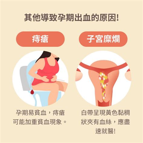 懷孕出血，麥驚!認識孕期三階段，各種懷孕出血之原因 - mamaway