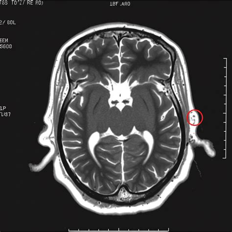 RadiobuddyAI - Radiology Advanced Medical Imaging Workflow Platform