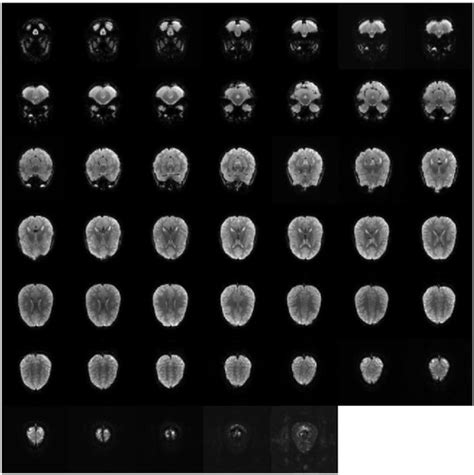 Custom 3D fMRI Registration Template Construction Method Based on Time ...
