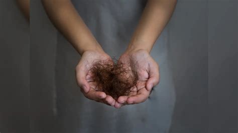 Biotin Deficiency,biotin for hair growth : முடி கொத்து கொத்தா கொட்டுதா ...