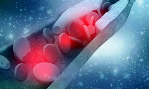 Osteoporosis Medications Denosumab and Alendronate Have No Significant ...