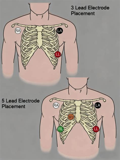 12 Lead ECG Placement: The Complete Guide (2025)