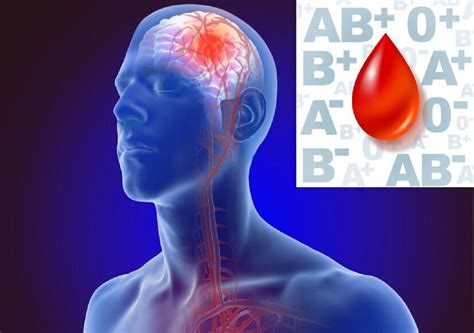 Blood Group Wise stroke Risk: এই ব্লাড গ্ৰুপৰ ব্যক্তিসকলৰ ষ্ট্ৰোকৰ ...
