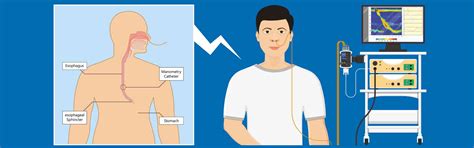 Manometry Test 的图像结果