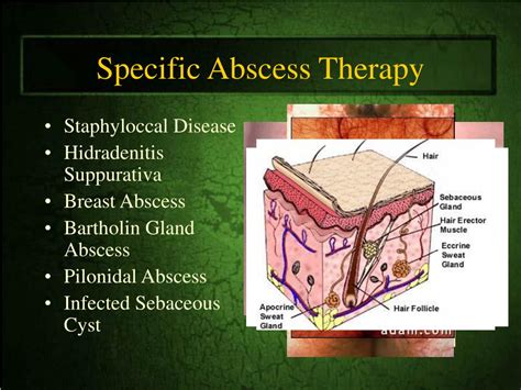 Image result for Axillary Abscess