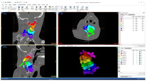 3D Printing in Surgical Planning and Intra-Operative Assistance: A Case ...