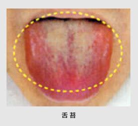 口臭の原因② 「舌」 これを克服するための舌磨き！|口臭なくして心もリフレッシュ！