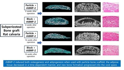 Long-Term Changes in Adipose Tissue in the Newly Formed Bone Induced by ...