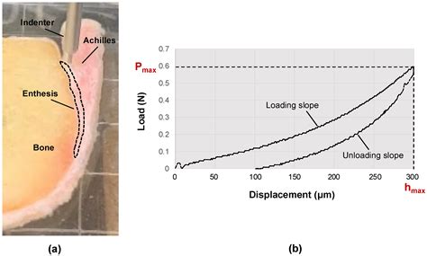 The Correlation between the Elastic Modulus of the Achilles Tendon ...