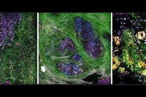 Novel imaging technique brings diagnostic potential into operating room