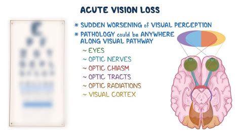 Image result for Post Acute Vision Statement
