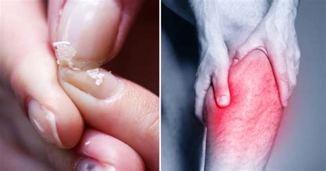 Image result for Calcium Buildup Signs