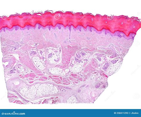 Human Thick Skin. Sole of the Foot Stock Image - Image of layer ...