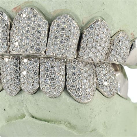 Diamond Grillz#N# #N# #N# #N# – Johnny Dang & Co