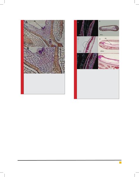 zygoteand synergids were observed in the embryo sac
